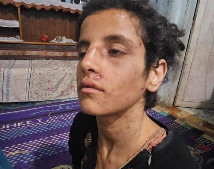 الأمن يكشف تعذيب طفلة على يد والدها وزوجة أبيها داخل حظيرة مواشي بالمنوفية