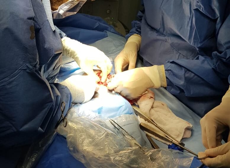 إنقاذ حياة مولود عمره يومان… نجاح تدخل جراحي دقيق لطفل يعاني من عيب خلقي نادر بالشرج والقلب