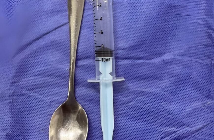 مستشفى شبين التعليمي تنجح في استخراج معلقة صغيرة من سيدة مسنة