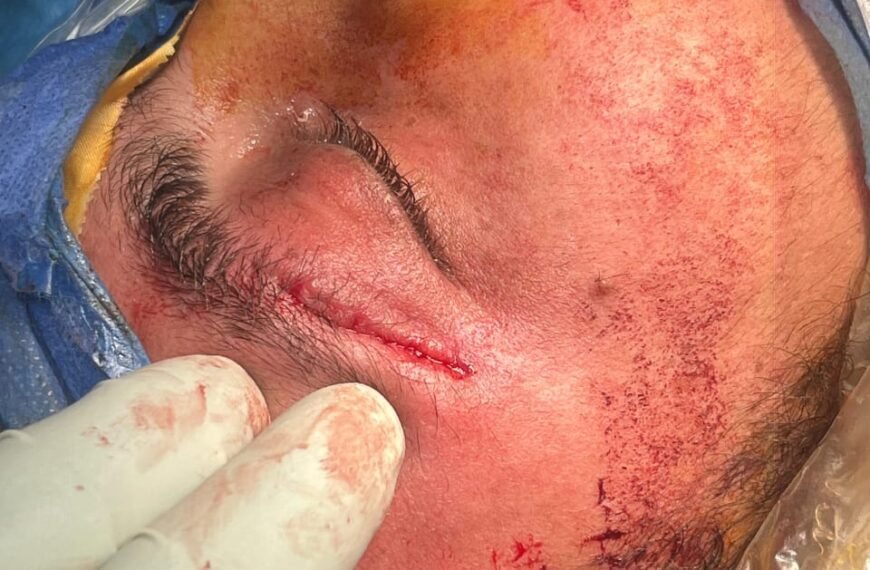 خلال شهر نوفمبر .. 18 جراحة معقّدة للوجه والفكين و131 حالة أطفال تحت التخدير العام بمستشفيات المنوفية