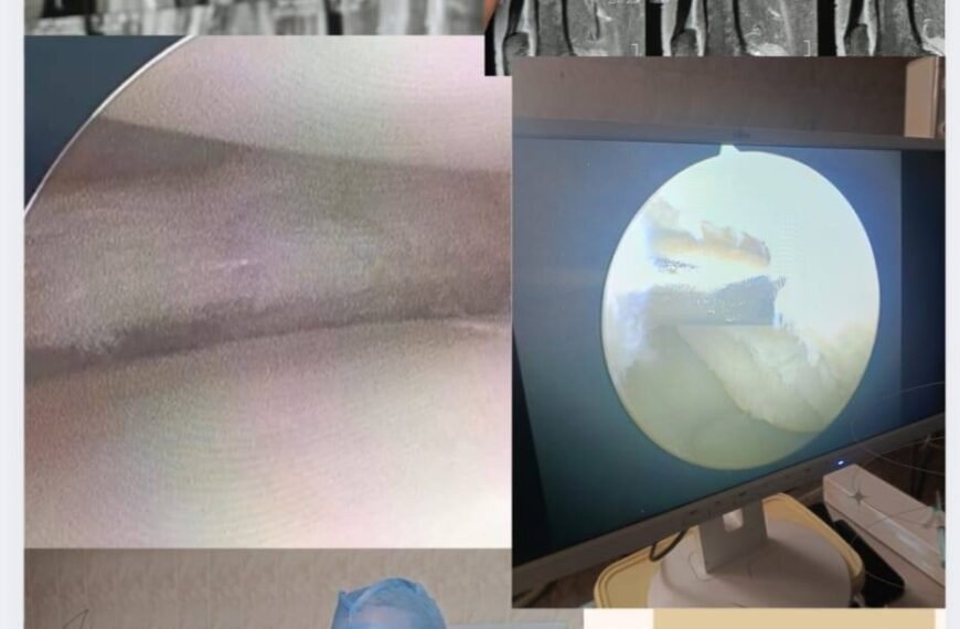 سابقة طبية بمستشفى بركة السبع.. إجراء أول منظار ركبة جراحي بقسم العظام بنجاح